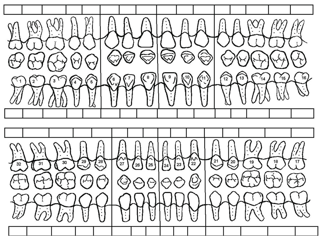 Perio Charting Template Perio Charting Template